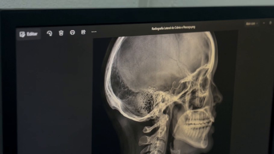 Exemplo real de imagem cefalométrica apresentada pela Nexa