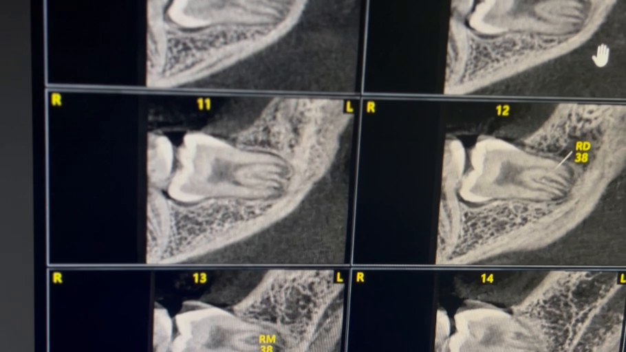 Imagem real de tomografia apresentada no sistema digital da Nexa